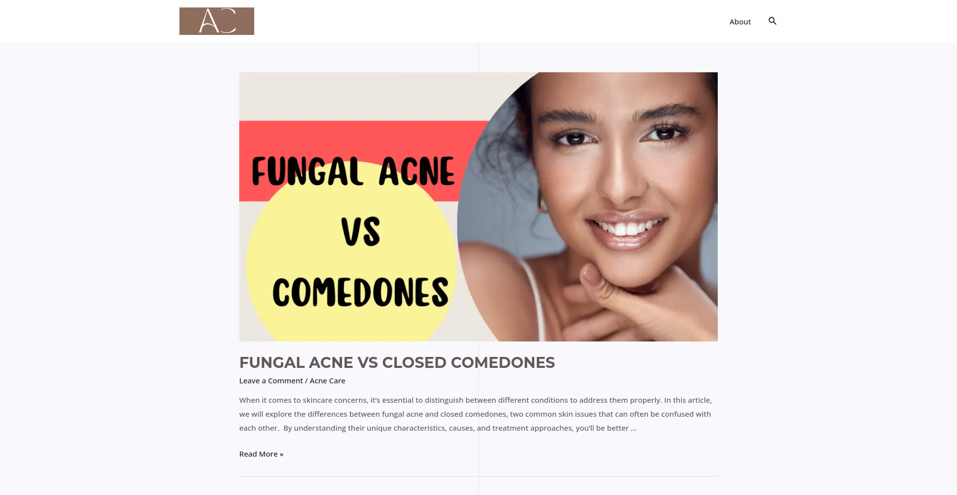 Screenshot of acnecaresolution.com homepage